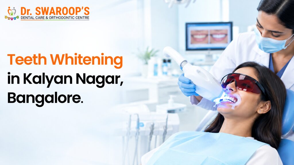 teeth whitening in bangalore