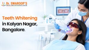 Teeth Whitening in Kalyan Nagar, Bangalore: How to Get a Brighter, More Confident Smile
